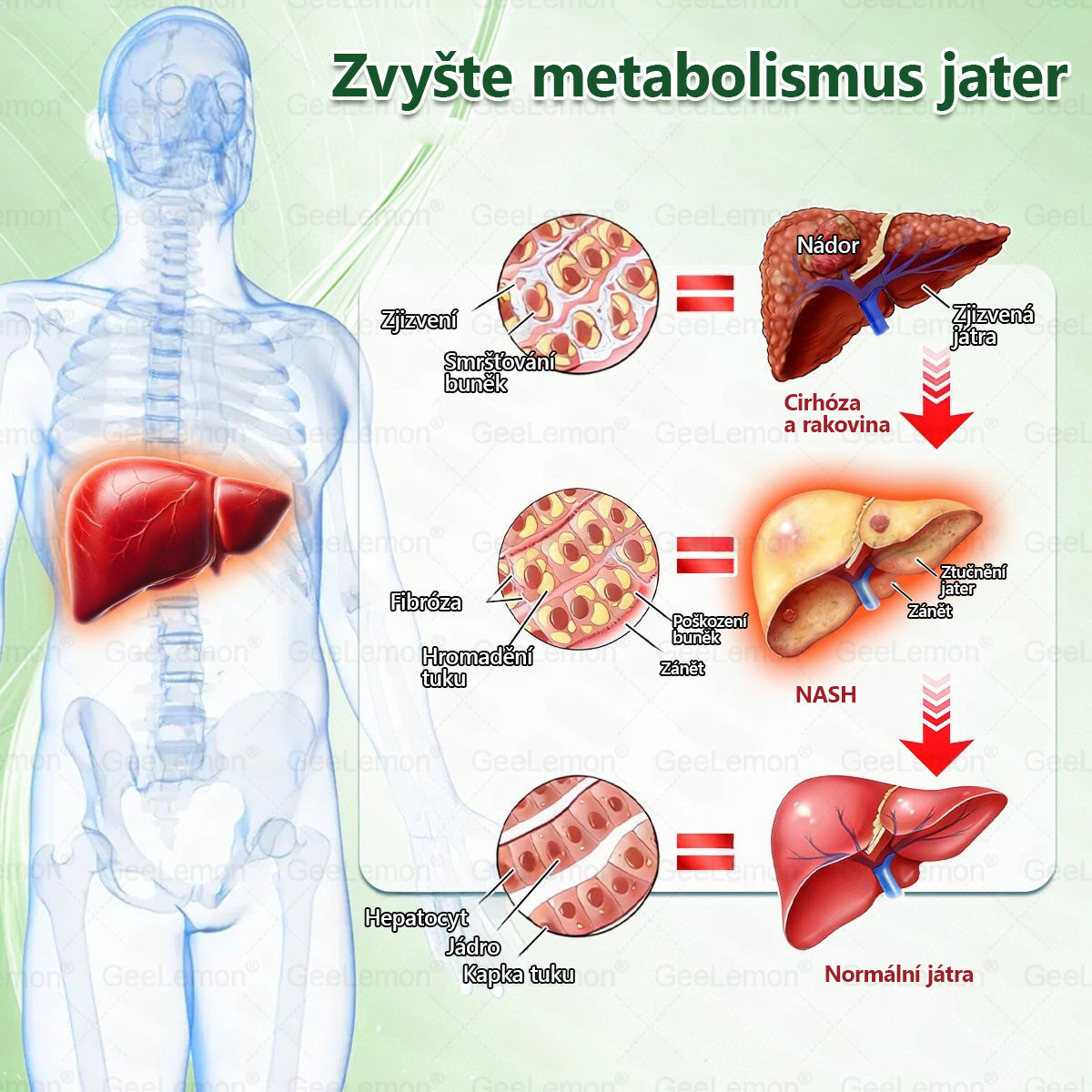 ⚡⚡ 𝐆𝐞𝑒𝑙𝑒𝐦𝐨𝐧® Glum𝐚𝐬𝐞tide 8 v 1 – Zeštíhlující nano mikrojihlový náplast 🇨🇿 Jen 1× denně ✅ Viditelné změny za 7 dní – na obezitu, kardiovaskulární zdraví, diabetes a kloubní problémy