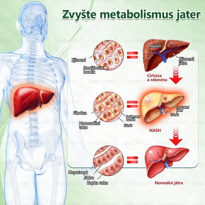 ⚡⚡ 𝐆𝐞𝑒𝑙𝑒𝐦𝐨𝐧® Glum𝐚𝐬𝐞tide 8 v 1 – Zeštíhlující nano mikrojihlový náplast 🇨🇿 Jen 1× denně ✅ Viditelné změny za 7 dní – na obezitu, kardiovaskulární zdraví, diabetes a kloubní problémy
