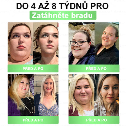 ⚡⚡ 𝐆𝐞𝑒𝑙𝑒𝐦𝐨𝐧® Glum𝐚𝐬𝐞tide 8 v 1 – Zeštíhlující nano mikrojihlový náplast 🇨🇿 Jen 1× denně ✅ Viditelné změny za 7 dní – na obezitu, kardiovaskulární zdraví, diabetes a kloubní problémy