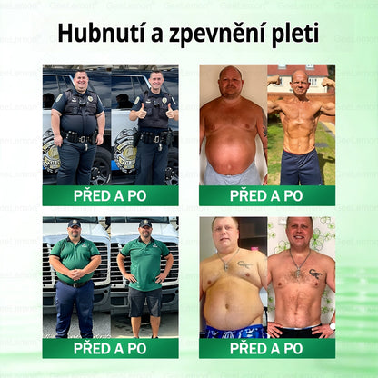 ⚡⚡ 𝐆𝐞𝑒𝑙𝑒𝐦𝐨𝐧® Glum𝐚𝐬𝐞tide 8 v 1 – Zeštíhlující nano mikrojihlový náplast 🇨🇿 Jen 1× denně ✅ Viditelné změny za 7 dní – na obezitu, kardiovaskulární zdraví, diabetes a kloubní problémy