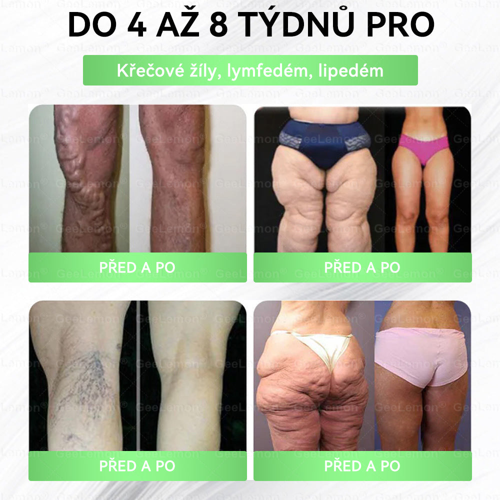 ⚡⚡ 𝐆𝐞𝑒𝑙𝑒𝐦𝐨𝐧® Glum𝐚𝐬𝐞tide 8 v 1 – Zeštíhlující nano mikrojihlový náplast 🇨🇿 Jen 1× denně ✅ Viditelné změny za 7 dní – na obezitu, kardiovaskulární zdraví, diabetes a kloubní problémy